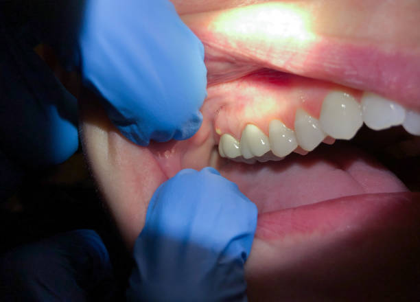  Marshall, TX Emergency Dentist Pros