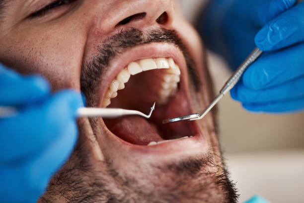 Best Emergency Root Canal Treatment in Marshall, TX