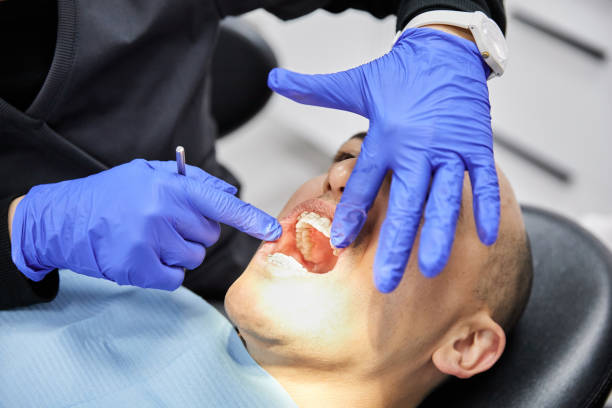 Best Emergency Wisdom Teeth Removal in Marshall, TX